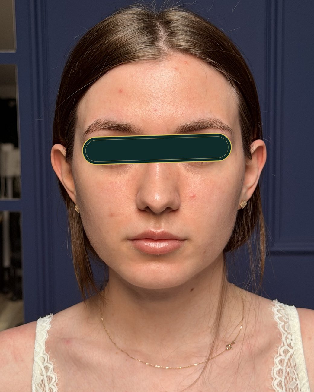 După masajul sculptural facial: contur mai definit, ten mai luminos
