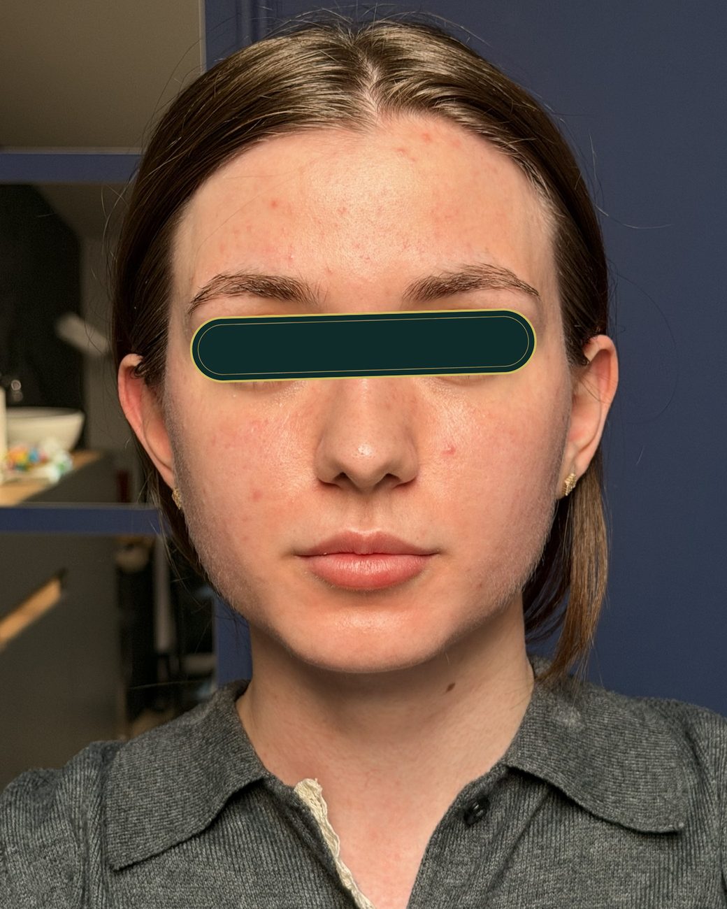 Înainte de masajul sculptural facial