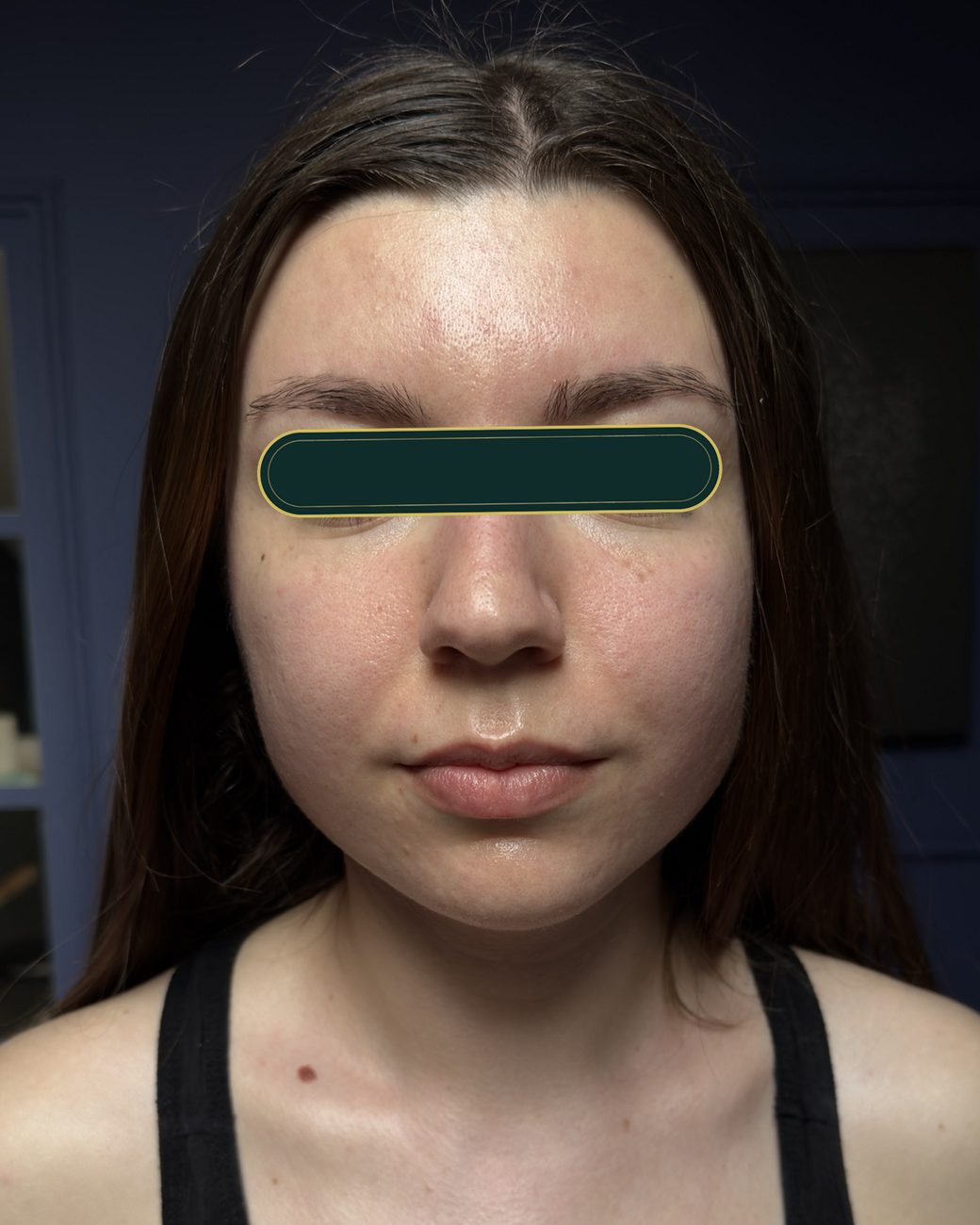 După masajul sculptural facial: oval mai definit, ten mai uniform