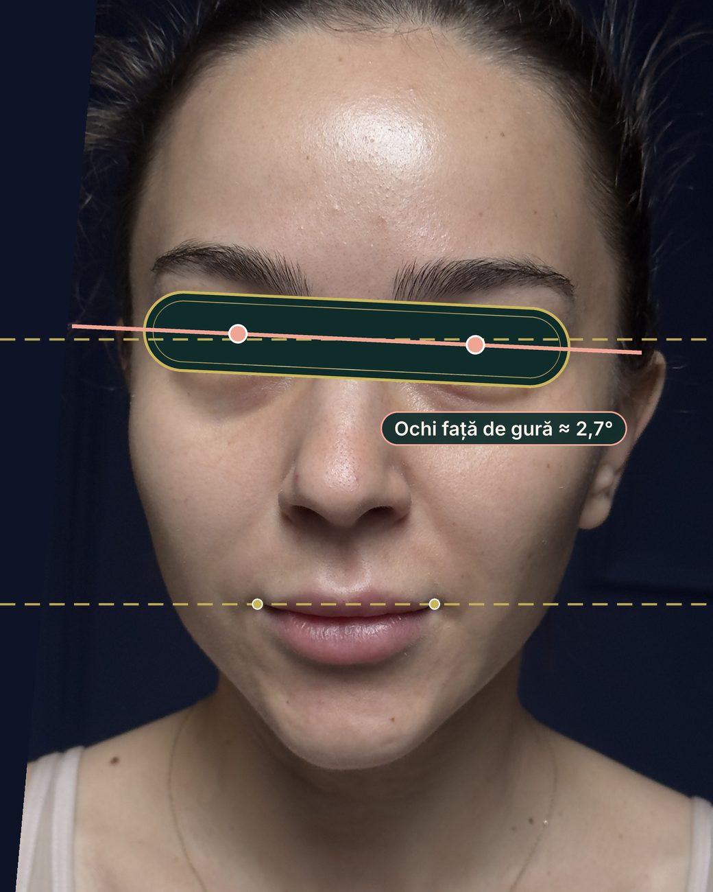Înainte de masajul sculptural facial: linia ochilor înclinată cu aproximativ 2,7 grade față de linia gurii