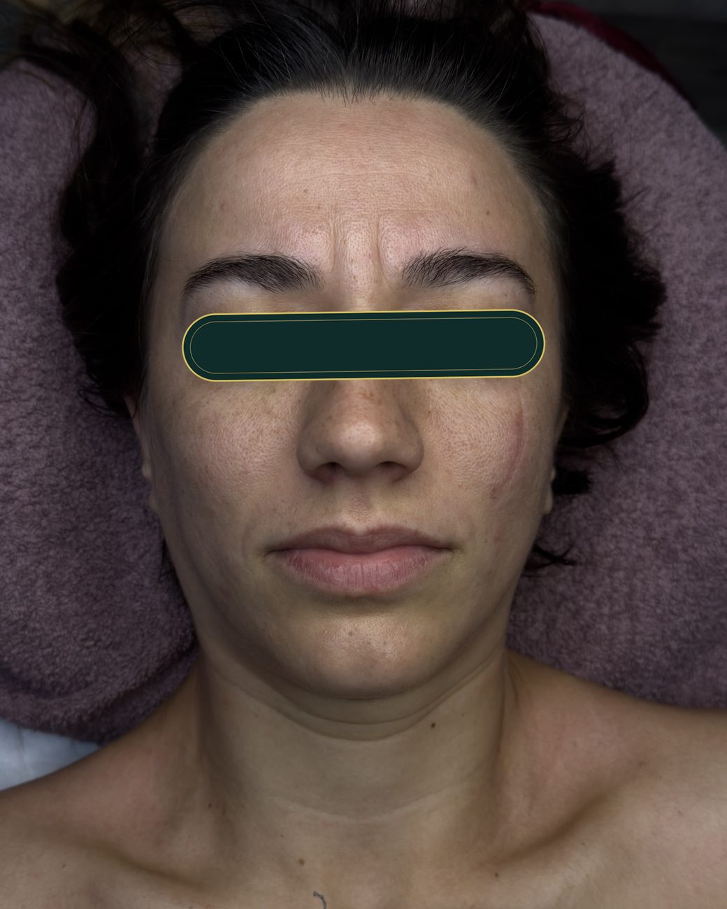 Înainte de masajul sculptural facial