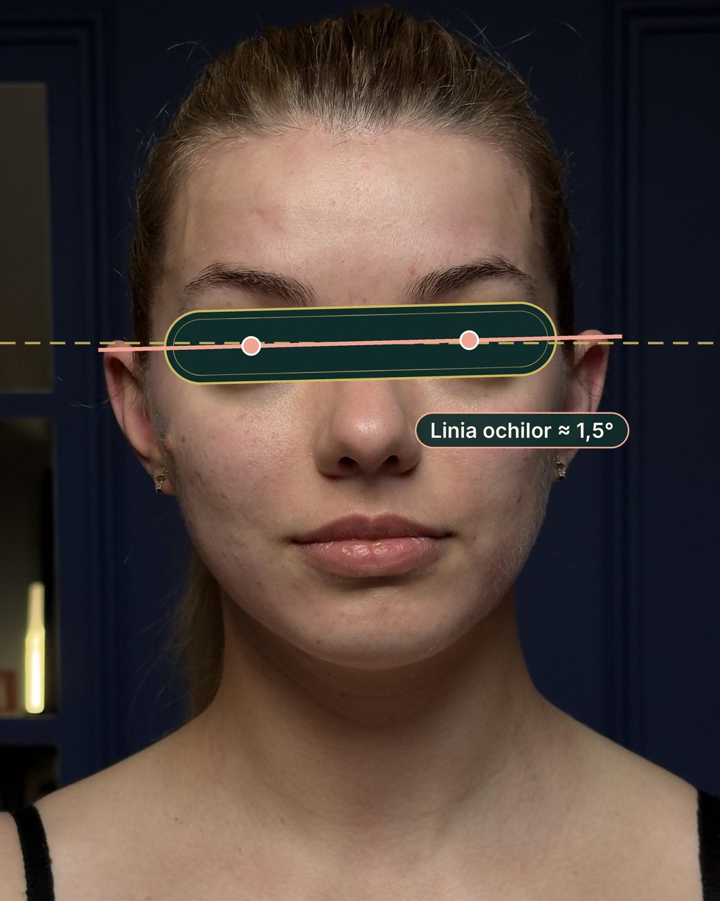 După masajul sculptural facial: linia ochilor aproape orizontală, înclinare de aproximativ 1,5 grade