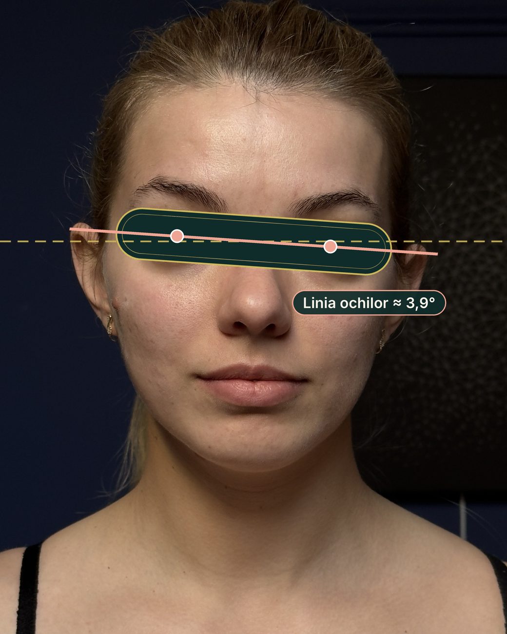 Înainte de masajul sculptural facial: linia ochilor înclinată cu aproximativ 3,9 grade