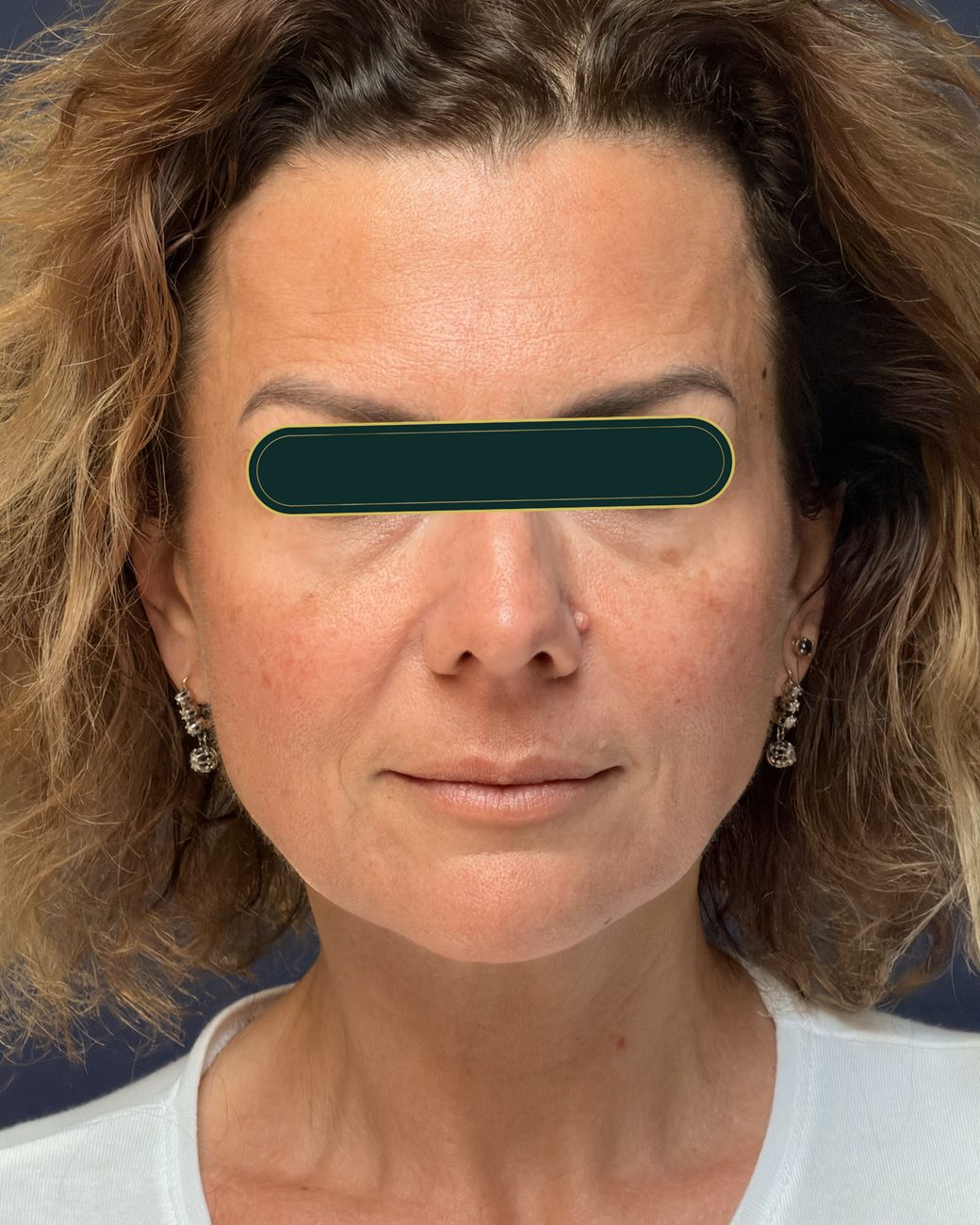 După masajul sculptural facial: ten mai luminos, oval mai ferm