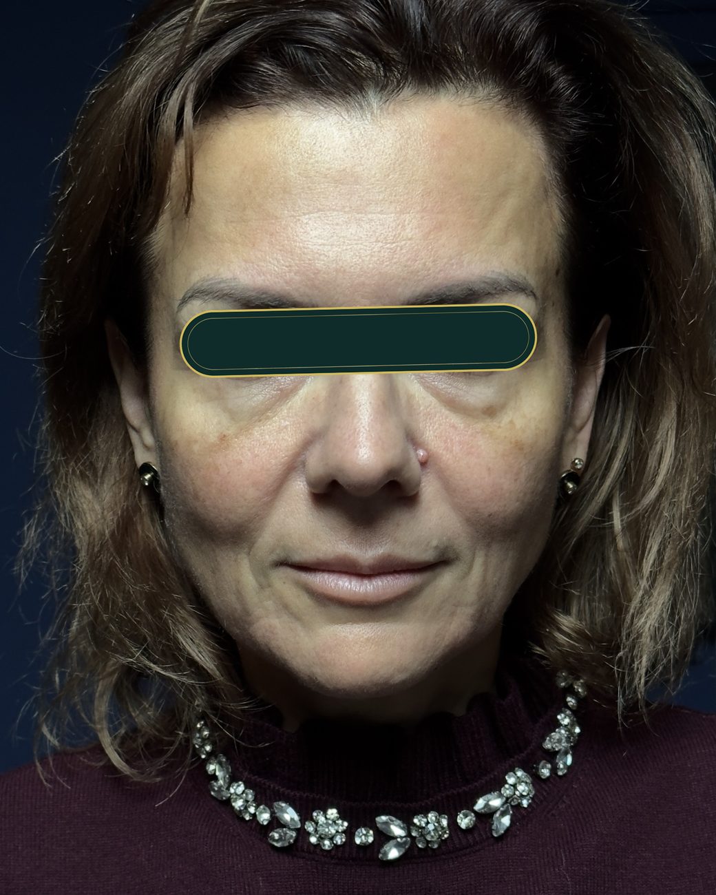 Înainte de masajul sculptural facial