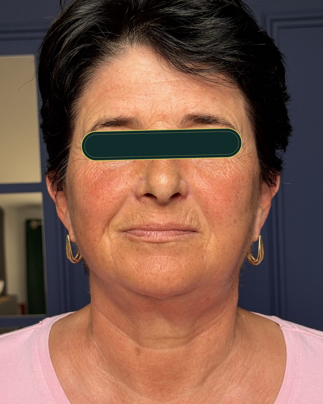După masajul sculptural facial: riduri mai estompate, față mai odihnită