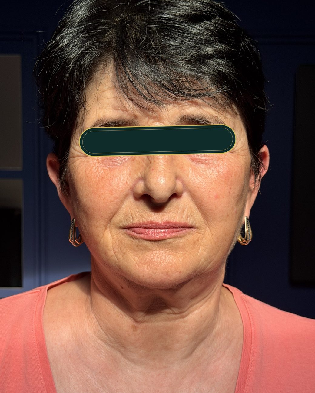 Înainte de masajul sculptural facial