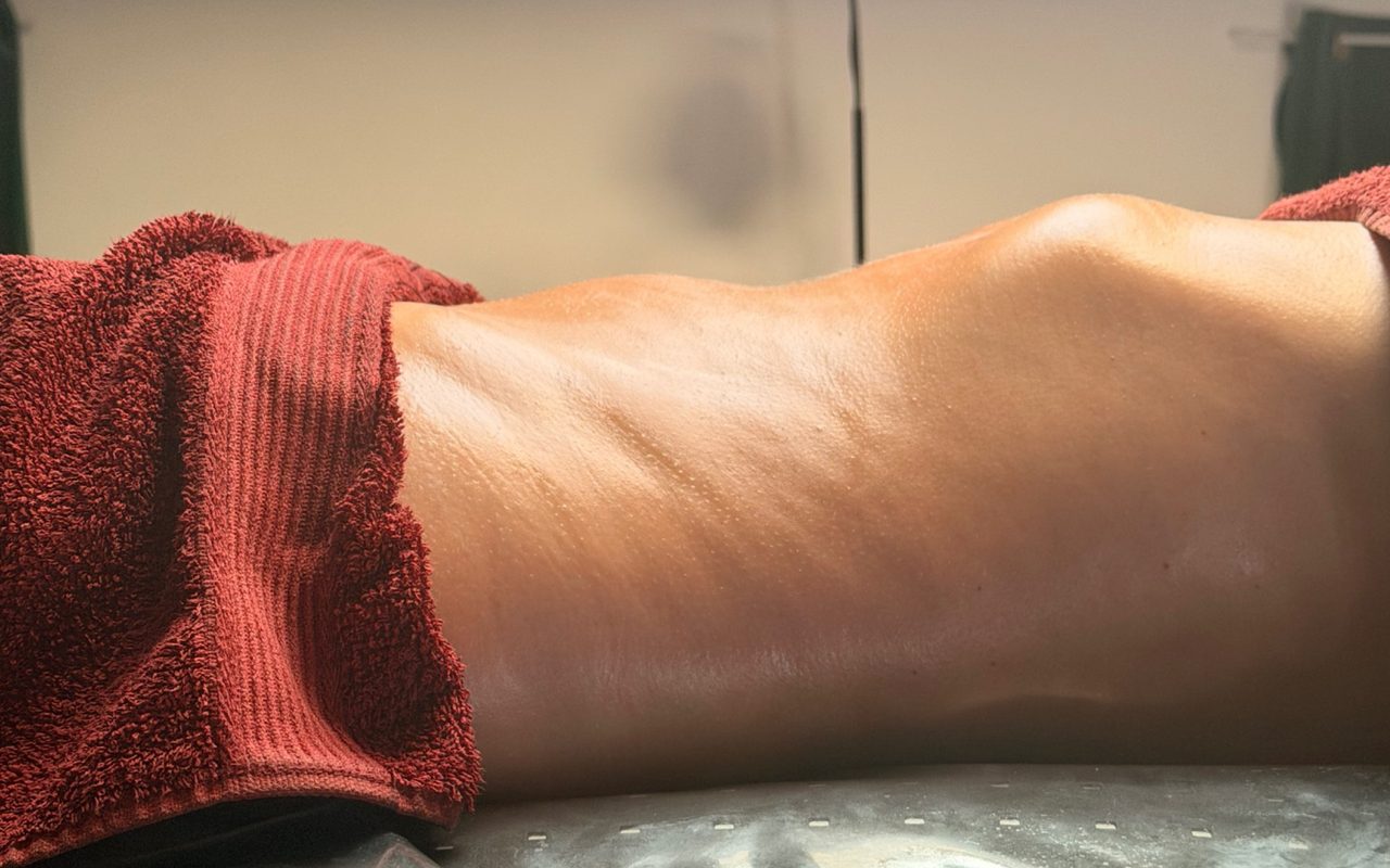 După ritualul limfatic: talie mai definită, abdomen mai plat