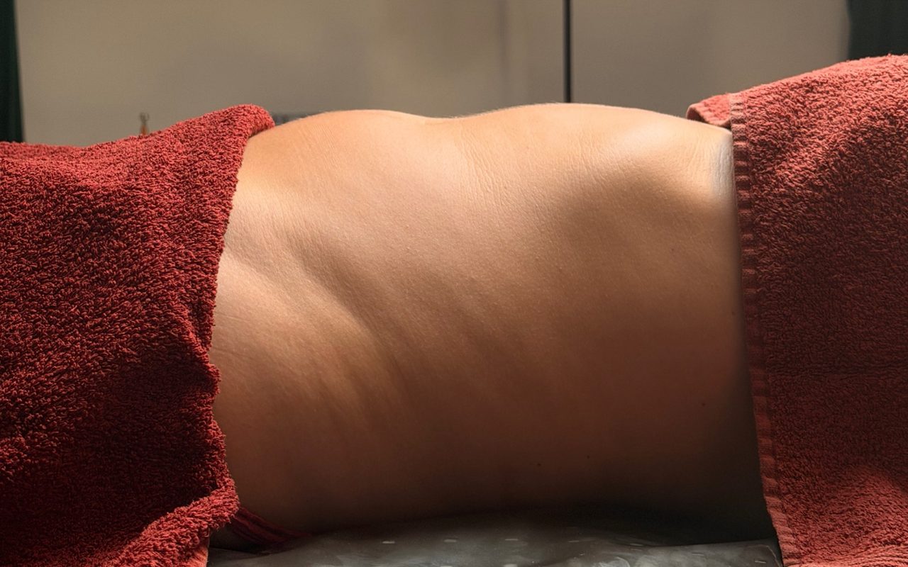 Înainte de ritualul limfatic, abdomen din profil